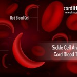 Sickle Cell Anaemia and Cord Blood Therapy