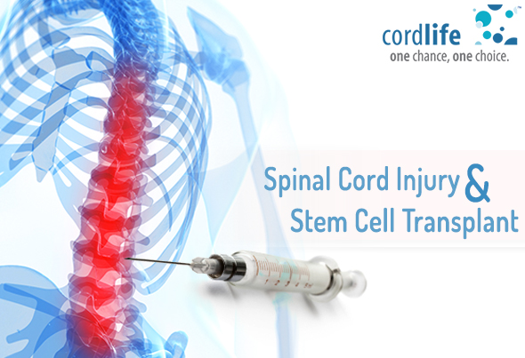 Spinal Cord Injury and Stem Cell Transplant