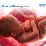 Positives of Storing the Umbilical Cord Stem Cells are numerous