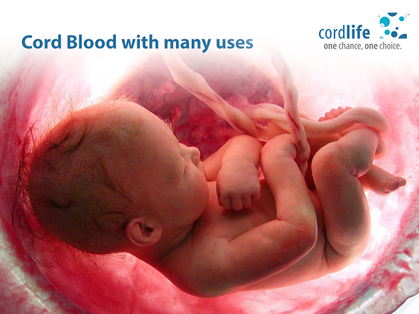 Umbilical Cord Blood with many uses
