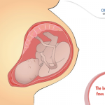 The Benefits Of Cells From Umbilical Cord Tissue