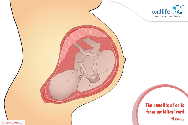 The Benefits Of Cells From Umbilical Cord Tissue