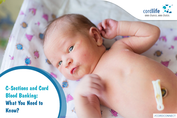 c section and cord blood banking