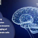 Measuring depression with non-invasive imaging of new brain cells