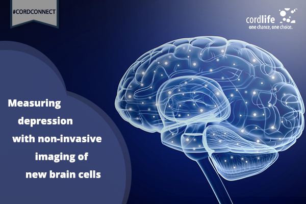 Measuring Depression With Non-invasive of New Brain Cells