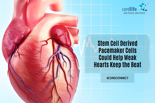 Stem cells derived pacemaker for weak hearts