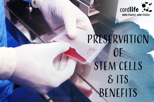 preservation of stem cell banking