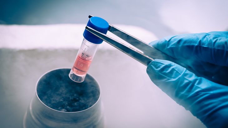 stem cell_Elena Pavlovich