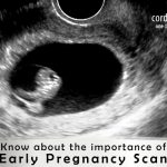 Know About The Importance Of Early Pregnancy Scan