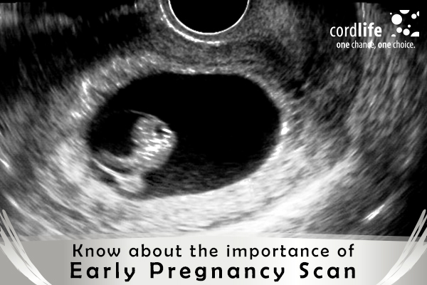 importance of early pregnancy scan