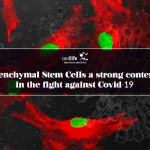Mesenchymal Stem Cells a Strong Contender in the Fight Against Covid-19