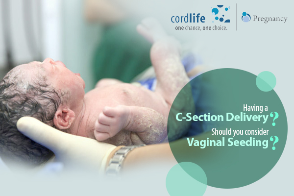 c-section delivery