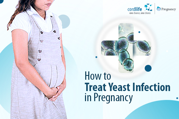 How to Treat Yeast Infection in Pregnancy - Cordlife India