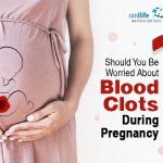 Should You Be Worried About Blood Clots During Pregnancy?