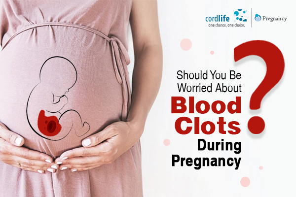 Should You Be Worried About Blood Clots During Pregnancy?