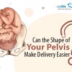 Can the Shape of Your Pelvis Make Delivery Easier?