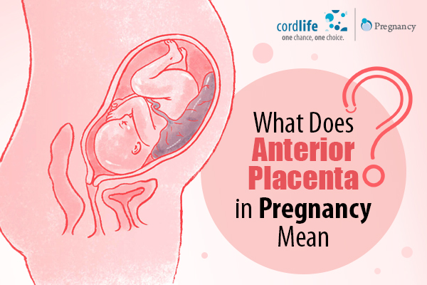 Anterior Placenta in Pregnancy