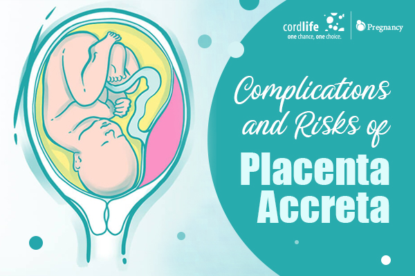 placenta accreta