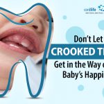 Don’t Let Crooked Teeth Get in the Way of Your Baby’s Happiness