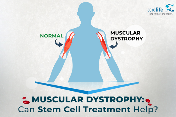 muscular dystrophy