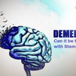 Dementia: Can It Be Treated With Stem Cells?