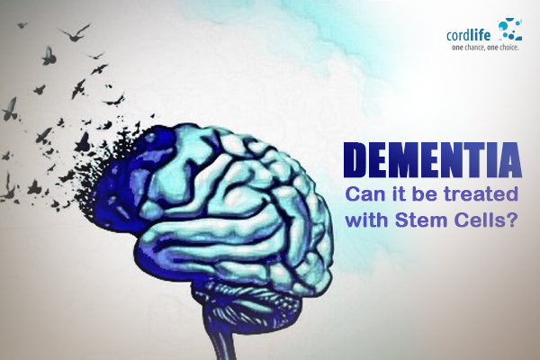 Dementia Disease Treatment with stem cells