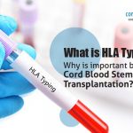 What is HLA Typing? Why is Important Before Cord Blood Stem Cell Transplantation?