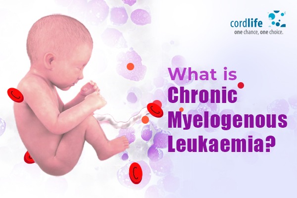 Chronic Myelogenous Leukaemia