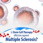 Is Stem Cell Therapy Effective Against Multiple Sclerosis?