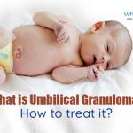 What Is Umbilical Granuloma? How To Treat It?