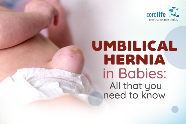 umbilical hernia in babies