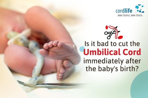 cutting umbilical cord