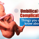 Umbilical Cord Complications: Things You Didn’t Know About