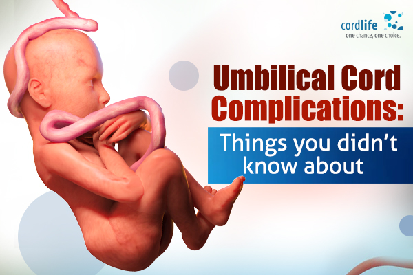 Umbilical Cord Complications - things you need to know
