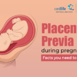 Placenta Previa During Pregnancy: Facts You Need To Know