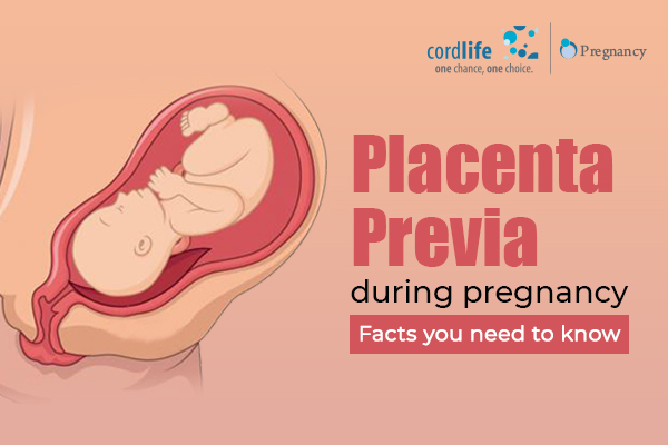 Placenta Previa during pregnancy Facts