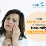 Treat Dark Circles During Pregnancy Naturally: An Essential Guide