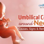 Umbilical Cord Around Neck: Causes, Signs & Remedies