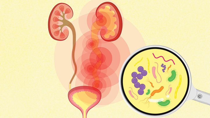 urinary tract infection symptoms in pregnancy