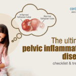 The Ultimate Pelvic Inflammatory Disease: Checklist & Treatment