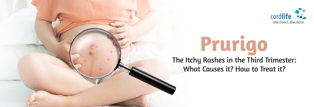 Itchy-Rashes-in-the-Third-Trimester