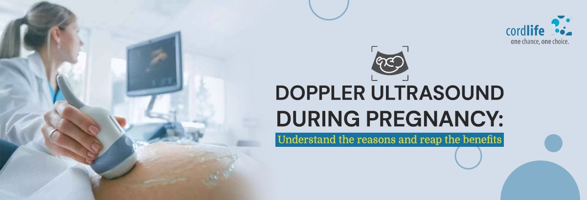 doppler ultrasound scan