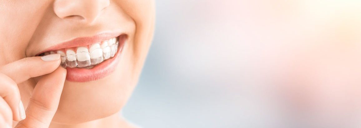 Beautiful smile and white teeth of a young woman.