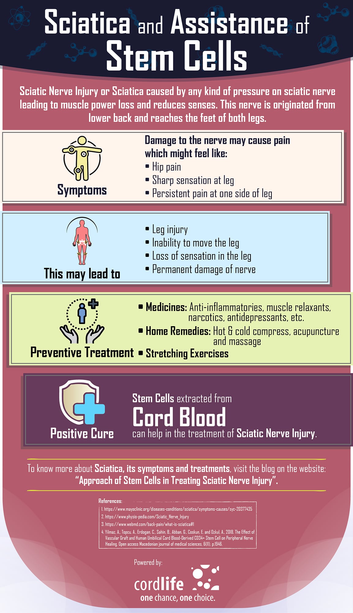 Sciatica And Assistance of Stem Cells