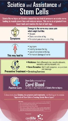 Sciatica And Assistance of Stem Cells thumbnail